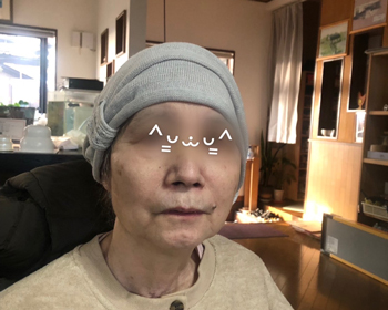 A・Fさん